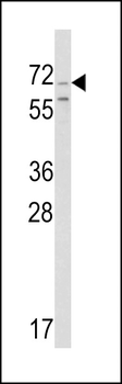 Chromogranin-C Antibody (Center)
