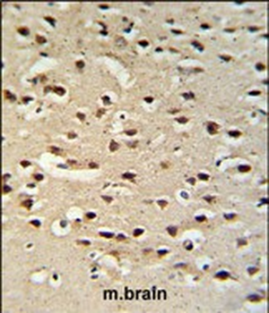 Chromogranin-C Antibody (Center)