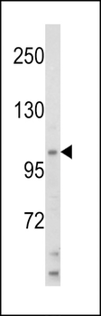 HIP116A Antibody (Center)