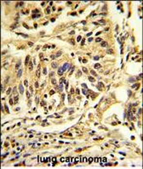 CEBPB Antibody (C-term)