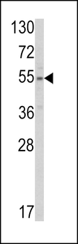 SLC38A3 Antibody (Center)