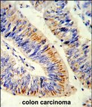 RELA Antibody (N-term)