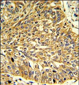 RGP1 Antibody (C-term)