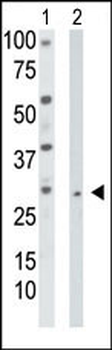 Thymidine Kinase 2 Antibody (N-term)