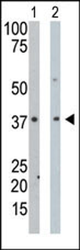 PDXK Antibody (N-term)