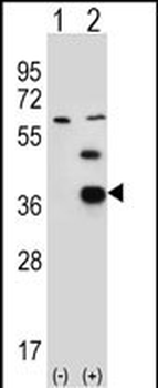 PDXK Antibody (N-term)