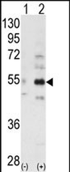 ALS2CR2 Antibody (C-term L289)