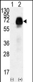 AMHR2 Antibody (N-term R80)