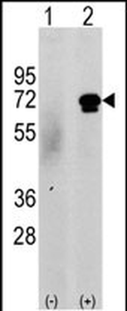 CAMKK2 Antibody (N-term G67)