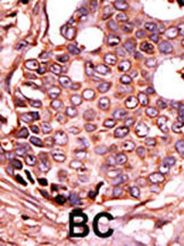 SEPSH2 Antibody (Center)
