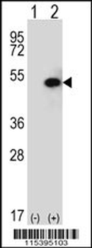 SPHK1 Antibody (C-term R414)