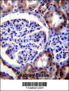 RICTOR Antibody (C-term)