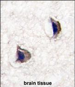 NP1(Nptx1) Antibody (Center)