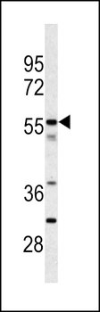 CPN2 Antibody (N-term)