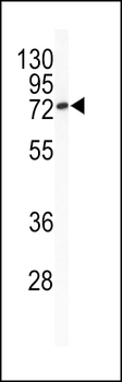 Bcl-6 Antibody (C-term)
