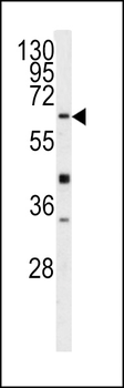 GGTLA1 Antibody (N-term)