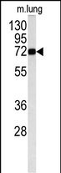MAOB Antibody (Center)