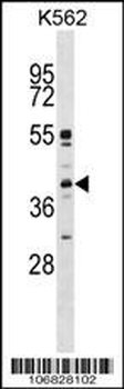 MAPK11 Antibody (Center)