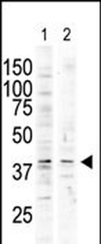 MAPK13 Antibody (C-term)