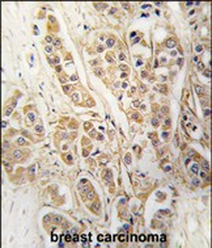 CLIC4 Antibody