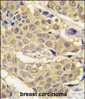 EPRS Antibody (N-term)