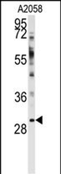 WBP2 Antibody (N-term)
