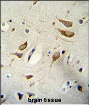 WBP2 Antibody (N-term)
