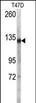 DSG2 Antibody (N-term T160)