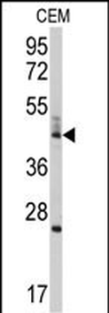 BCL2L13 Antibody (Center)