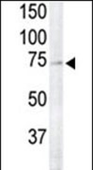 RSK4 Antibody (N-term)