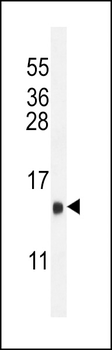 LHB Antibody (C-term)