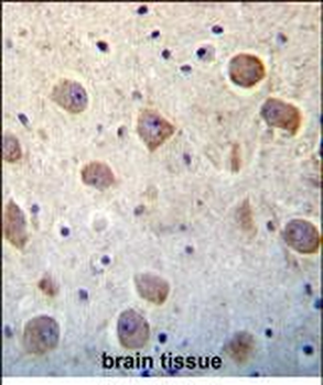 UTS2 Antibody (N-term)