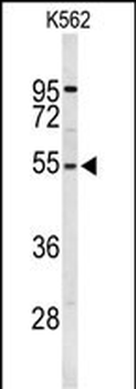RPS6KB2 Antibody