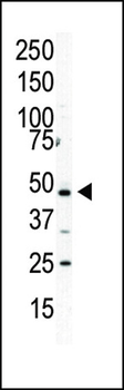 PIP4K2 Alpha (PIP4K2A) Antibody (C-term)