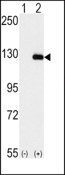 BUBR1 (BUB1B) Antibody (N-term)