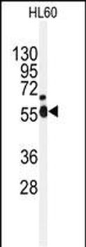 NEK2 Antibody (Center)
