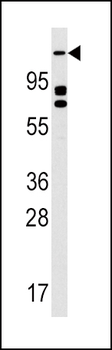 ULK2 Antibody (N-term)