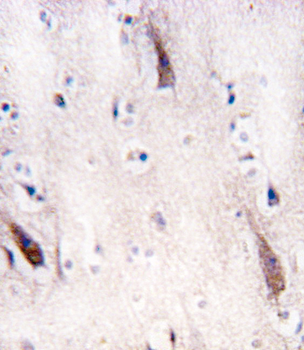 ULK2 Antibody (N-term)
