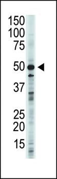 GSK3 beta (GSK3B) Antibody (N-term)