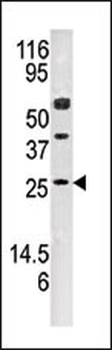 AK3 Antibody (N-term F210)