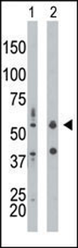 PKR (PRKR) Antibody (N-term)