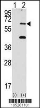 PKR (PRKR) Antibody (N-term)