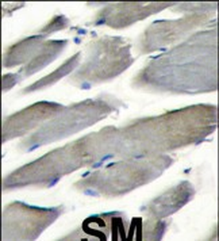 PI3KCG Antibody (Center)