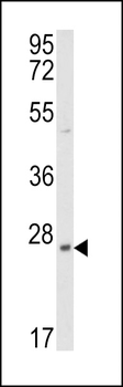 PRL3 Antibody