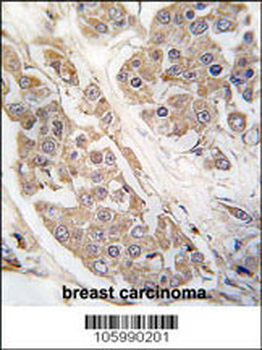CTDSP2 Antibody (N-term)