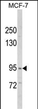 VPS53 Antibody (N-term)