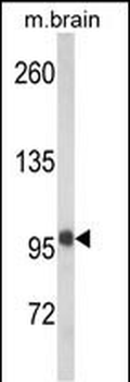 VPS53 Antibody (N-term)