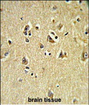 VPS53 Antibody (N-term)