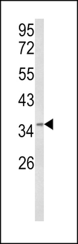 HSPC142 Antibody (Center)