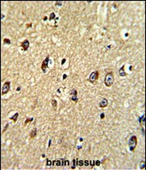 ABCC5 Antibody (Center)